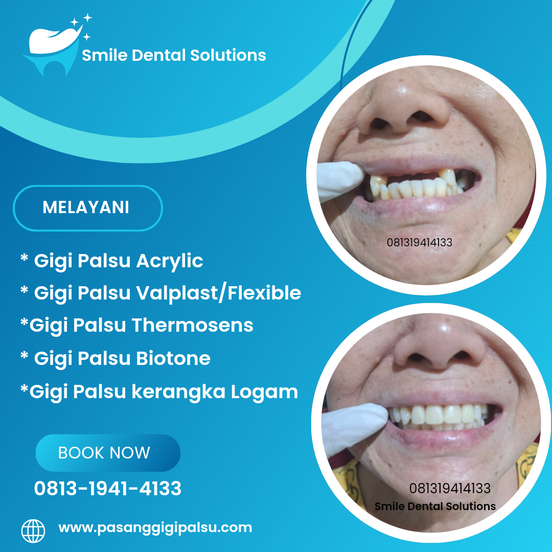 Tukang Gigi Palsu di Bogor